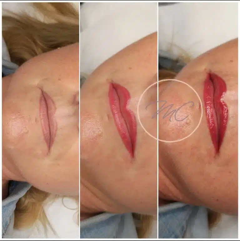 Reprise ancien contour fait ailleurs